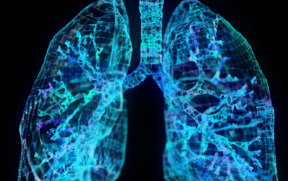 COVID-19 and chest CT webinar