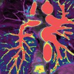 Tendences kvalitatīvu izmeklējumu nodrošināšanā, 22.11.2025., Teams